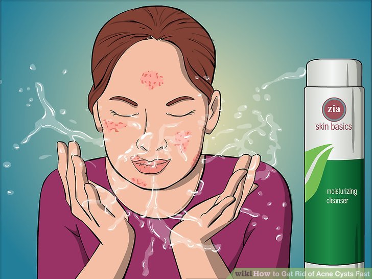 Sebaceous cyst on face how to get rid of fast